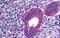 Phospholipase A2 Group IVA antibody, NBP1-52050, Novus Biologicals, Immunohistochemistry paraffin image 