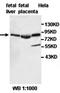 Hook Microtubule Tethering Protein 2 antibody, orb77786, Biorbyt, Western Blot image 