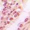 Pro-Apoptotic WT1 Regulator antibody, LS-C352633, Lifespan Biosciences, Immunohistochemistry frozen image 