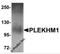 Pleckstrin Homology And RUN Domain Containing M1 antibody, 5483, ProSci, Western Blot image 