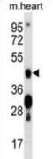 Calcium/Calmodulin Dependent Protein Kinase IV antibody, abx028576, Abbexa, Western Blot image 