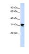 Ring Finger Protein 182 antibody, NBP1-59762, Novus Biologicals, Western Blot image 