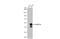 Homeobox C10 antibody, GTX636633, GeneTex, Western Blot image 