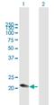 Complement C1q C Chain antibody, H00000714-B01P, Novus Biologicals, Western Blot image 