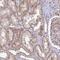 Zinc Finger CCCH-Type Containing 13 antibody, NBP2-48705, Novus Biologicals, Immunohistochemistry paraffin image 