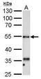 Hyaluronidase 1 antibody, GTX113747, GeneTex, Western Blot image 