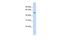 URI1 Prefoldin Like Chaperone antibody, PA5-43630, Invitrogen Antibodies, Western Blot image 