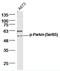 Parkin RBR E3 Ubiquitin Protein Ligase antibody, orb312554, Biorbyt, Western Blot image 