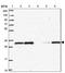 Olfactory Receptor Family 10 Subfamily C Member 1 (Gene/Pseudogene) antibody, NBP2-13691, Novus Biologicals, Western Blot image 