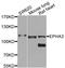 EPH Receptor A3 antibody, orb374108, Biorbyt, Western Blot image 