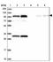 Solute Carrier Family 12 Member 7 antibody, NBP1-85133, Novus Biologicals, Western Blot image 