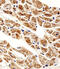 Zinc finger protein OTK18 antibody, A10816, Boster Biological Technology, Immunohistochemistry paraffin image 