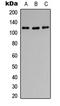 Protein Tyrosine Kinase 2 antibody, LS-C358851, Lifespan Biosciences, Western Blot image 