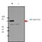 Huntingtin antibody, MA1-115, Invitrogen Antibodies, Western Blot image 