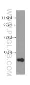 Inositol Polyphosphate-5-Phosphatase K antibody, 15098-1-AP, Proteintech Group, Western Blot image 