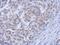 ABL Proto-Oncogene 1, Non-Receptor Tyrosine Kinase antibody, NBP2-15631, Novus Biologicals, Immunohistochemistry frozen image 