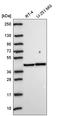 Protein Kinase CAMP-Activated Catalytic Subunit Alpha antibody, HPA071185, Atlas Antibodies, Western Blot image 