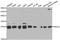 Peroxiredoxin 3 antibody, STJ25104, St John