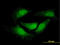 Nuclear Receptor Subfamily 0 Group B Member 1 antibody, LS-C196629, Lifespan Biosciences, Immunofluorescence image 