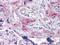 Endoplasmic Reticulum To Nucleus Signaling 1 antibody, MA5-15617, Invitrogen Antibodies, Immunohistochemistry frozen image 