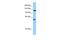 Tolloid-like protein 1 antibody, A07099, Boster Biological Technology, Western Blot image 