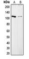 Collagen Type VI Alpha 2 Chain antibody, GTX55141, GeneTex, Western Blot image 