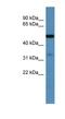 Zinc Finger DHHC-Type Containing 3 antibody, NBP1-68903, Novus Biologicals, Western Blot image 