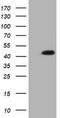 Isovaleryl-CoA Dehydrogenase antibody, TA501670, Origene, Western Blot image 