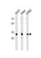 Amyloid Beta Precursor Protein Binding Family B Member 3 antibody, abx034844, Abbexa, Western Blot image 