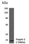 Peptidase Inhibitor 3 antibody, GTX53037, GeneTex, Western Blot image 