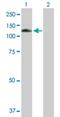 Mannosidase Beta antibody, H00004126-B01P, Novus Biologicals, Western Blot image 
