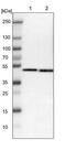 Small RNA Binding Exonuclease Protection Factor La antibody, NBP1-82851, Novus Biologicals, Western Blot image 
