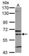 5-aminolevulinate synthase, erythroid-specific, mitochondrial antibody, TA308176, Origene, Western Blot image 