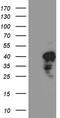 Chitinase Acidic antibody, CF811224, Origene, Western Blot image 