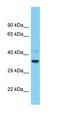 Transmembrane Protein 26 antibody, orb327119, Biorbyt, Western Blot image 