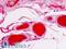 Alpha-1-antitrypsin antibody, LS-B9028, Lifespan Biosciences, Immunohistochemistry paraffin image 