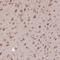 Eukaryotic Translation Initiation Factor 2 Subunit Alpha antibody, HPA064885, Atlas Antibodies, Immunohistochemistry paraffin image 