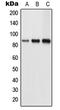 Tousled Like Kinase 1 antibody, LS-C353212, Lifespan Biosciences, Western Blot image 