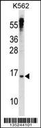 MAX Dimerization Protein 3 antibody, 58-274, ProSci, Western Blot image 