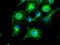 Tubulin Alpha 8 antibody, M08793-1, Boster Biological Technology, Immunofluorescence image 