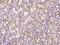 Protein Tyrosine Kinase 7 (Inactive) antibody, 204330-T10, Sino Biological, Immunohistochemistry frozen image 