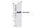 Coactivator Associated Arginine Methyltransferase 1 antibody, 3379S, Cell Signaling Technology, Western Blot image 