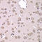 Heterogeneous Nuclear Ribonucleoprotein M antibody, LS-C348998, Lifespan Biosciences, Immunohistochemistry paraffin image 