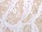 ADAM Metallopeptidase Domain 28 antibody, MBS2521466, MyBioSource, Immunohistochemistry frozen image 