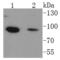 Forkhead Box O1 antibody, NBP2-67463, Novus Biologicals, Western Blot image 