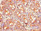 Serine Protease 2 antibody, CSB-PA018814LA01HU, Cusabio, Immunohistochemistry frozen image 