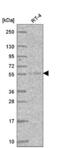 Atlastin GTPase 3 antibody, NBP2-56000, Novus Biologicals, Western Blot image 
