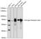 Estrogen Receptor 2 antibody, 18-700, ProSci, Western Blot image 