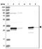 Histamine N-Methyltransferase antibody, NBP2-38253, Novus Biologicals, Western Blot image 