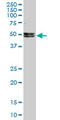 Neuro-oncological ventral antigen 1 antibody, LS-C139334, Lifespan Biosciences, Western Blot image 